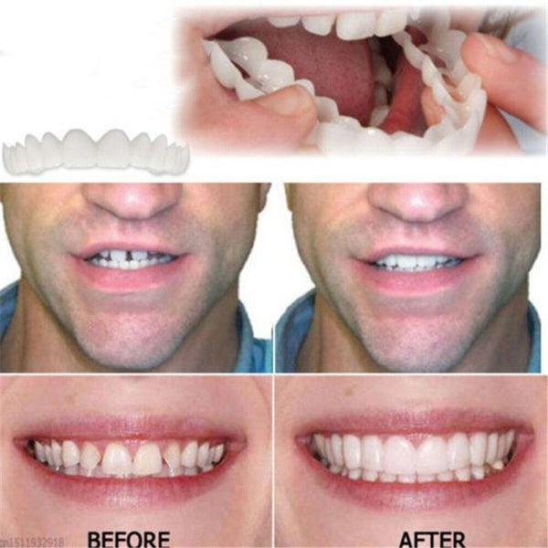 🎉 Last Few Days: 58% Off 🎉 Clip-On Dentures
