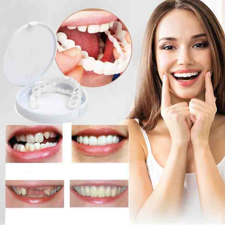 🎉Last Days 58%OFF 🎉Snap-On Dentures mysite