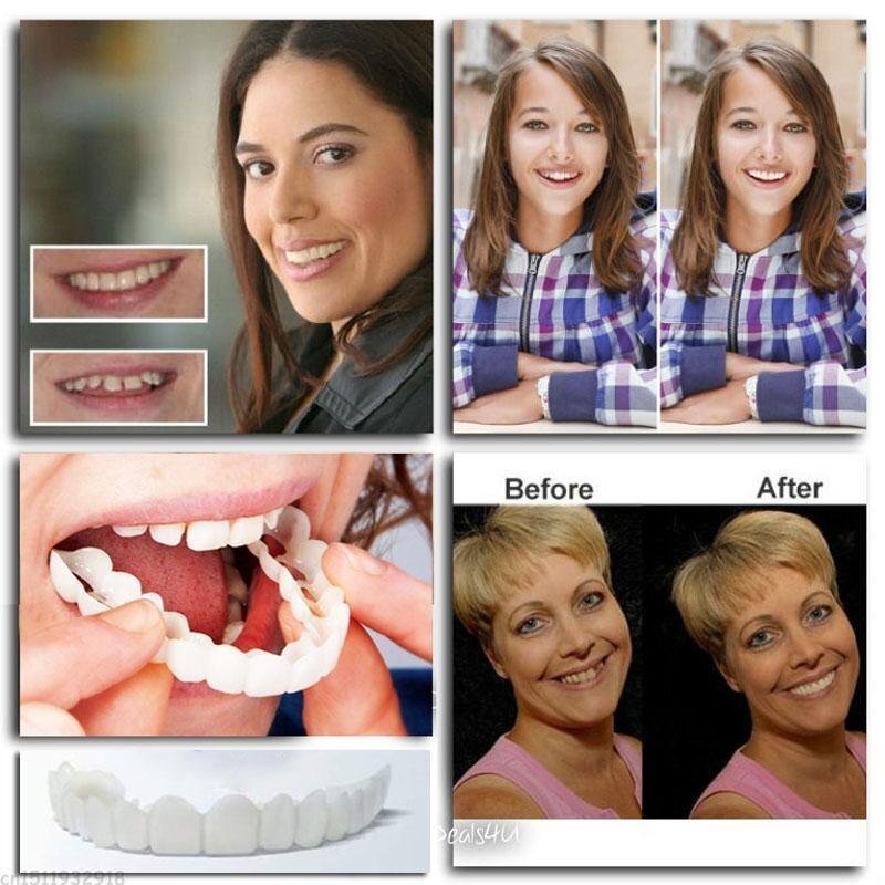 🎉Last Days 58%OFF 🎉Snap-On Dentures mysite